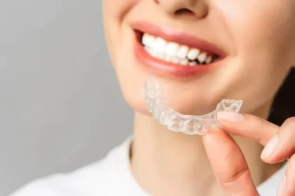 Clear Aligners